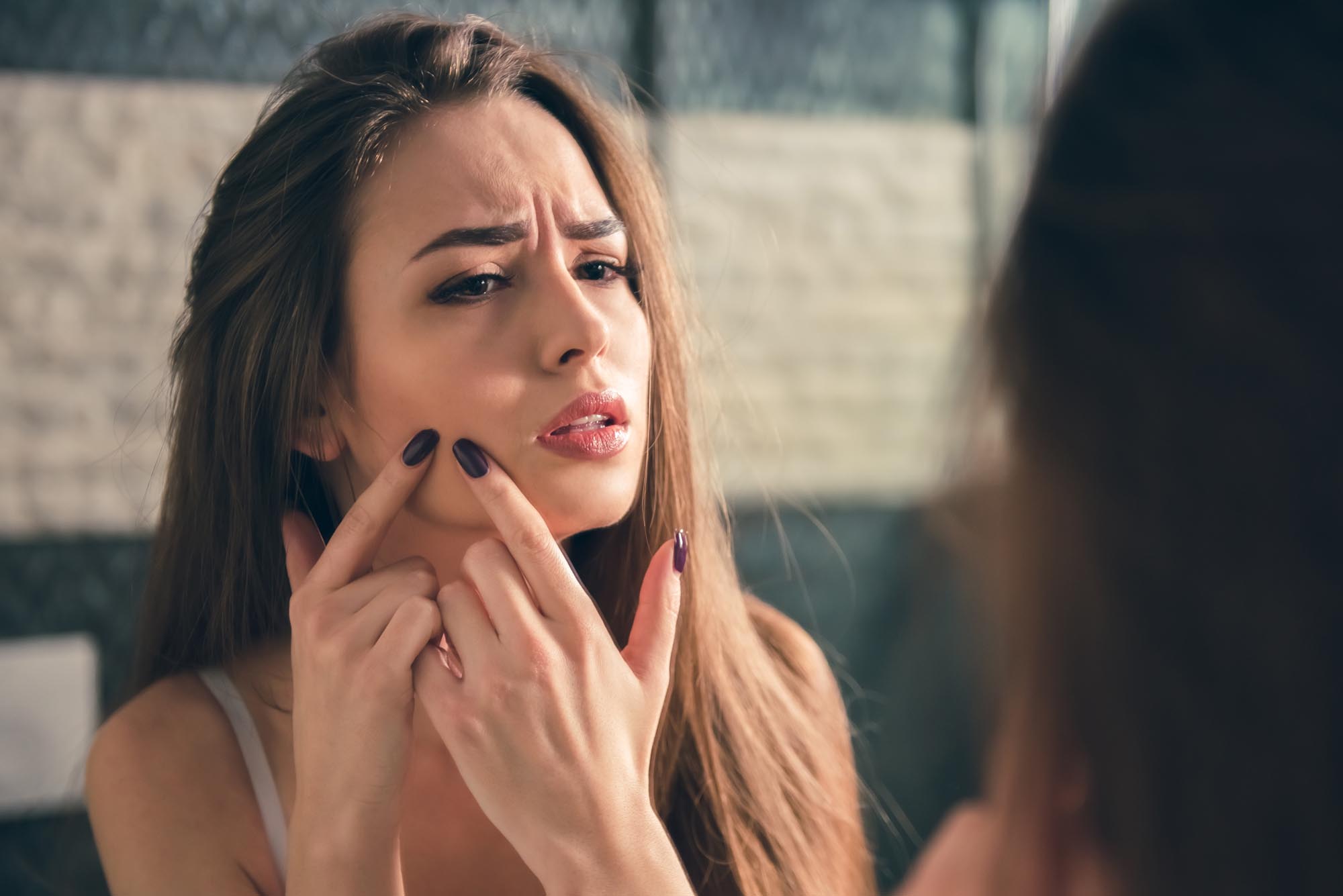 Accutane and Mental Health